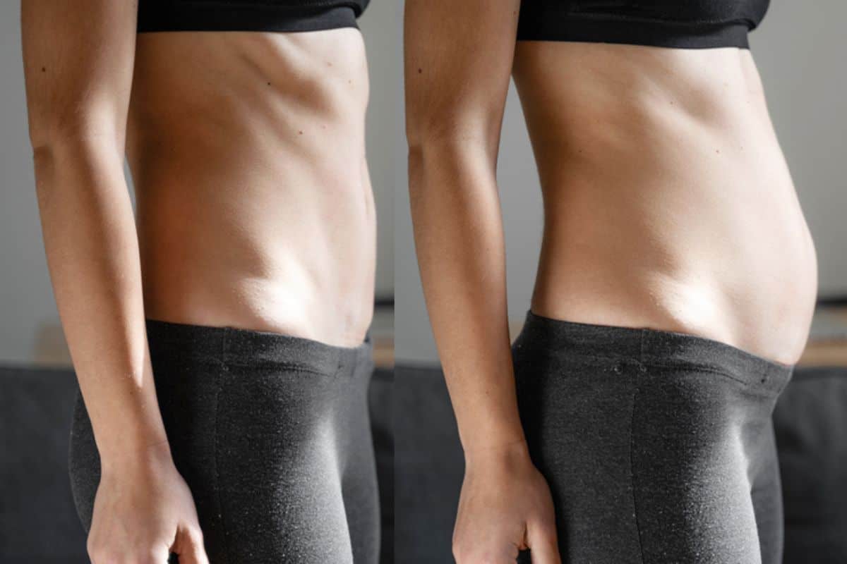 How long does diastasis recti take to improve Moss Side?