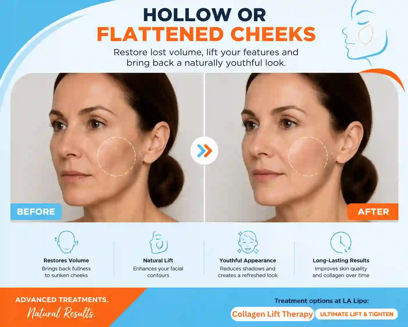 Sign #4: Hollow or Flattened Cheeks Moss Side