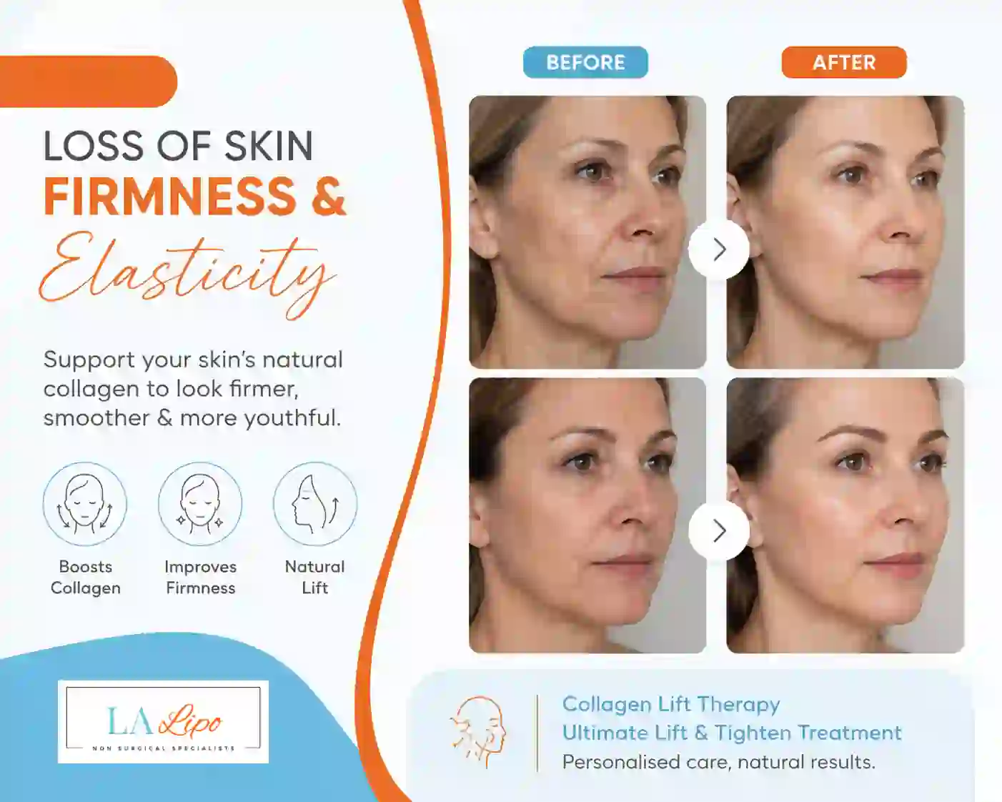 Sign #7: Loss of Skin Firmness and Elasticity Moss Side