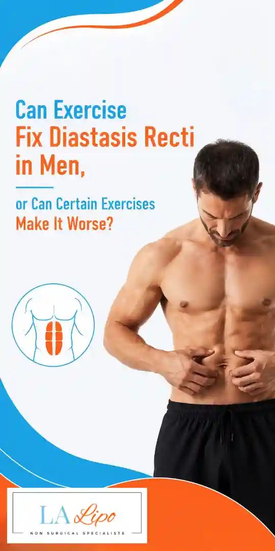 Can Exercise Fix Diastasis Recti in Men, or Can Certain Exercises Make It Worse Moss Side?